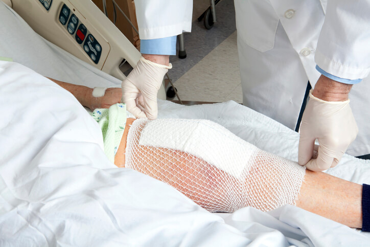 Patient's injured leg on hospital bed